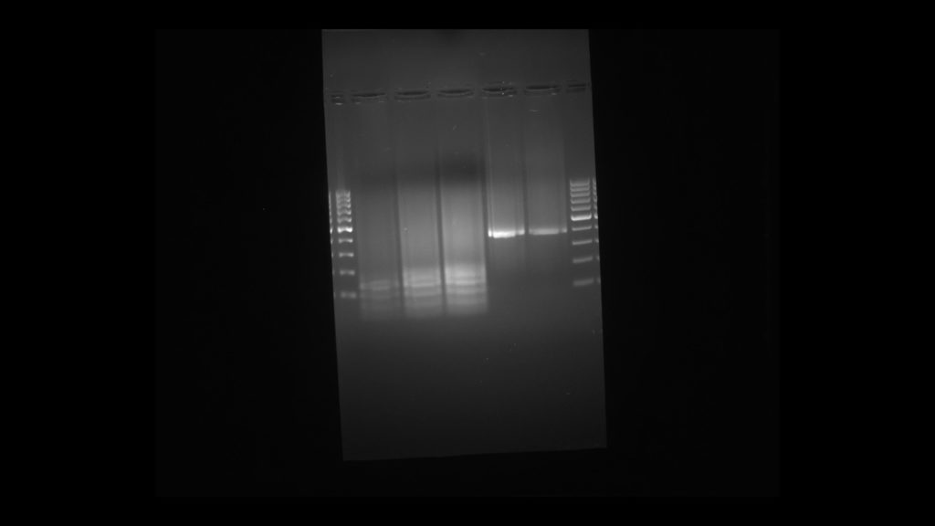 Lactose intolerance DNA fingerprint